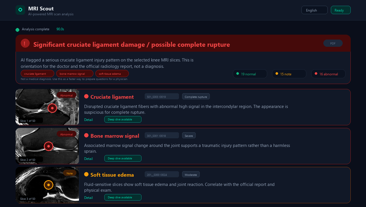 MRI Scout real run summary with OpenAI gpt-4o